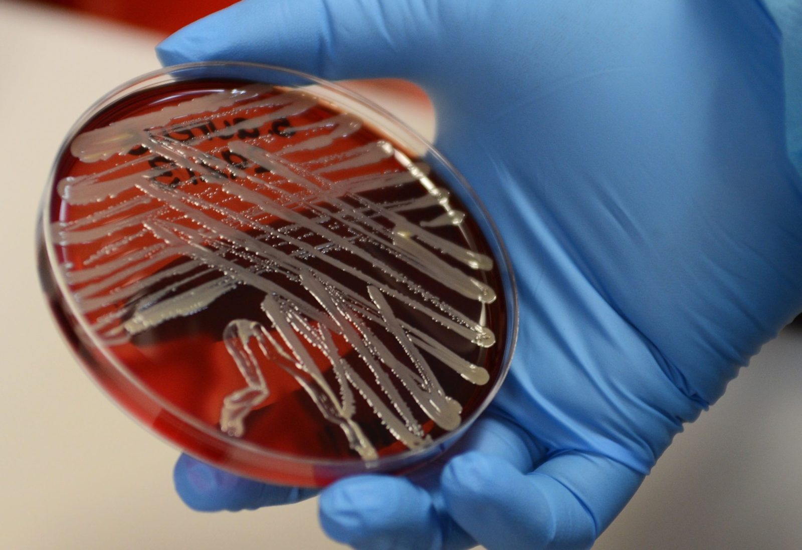 RNA Sequencing For Bacterial Transcriptomes | The DNA Universe